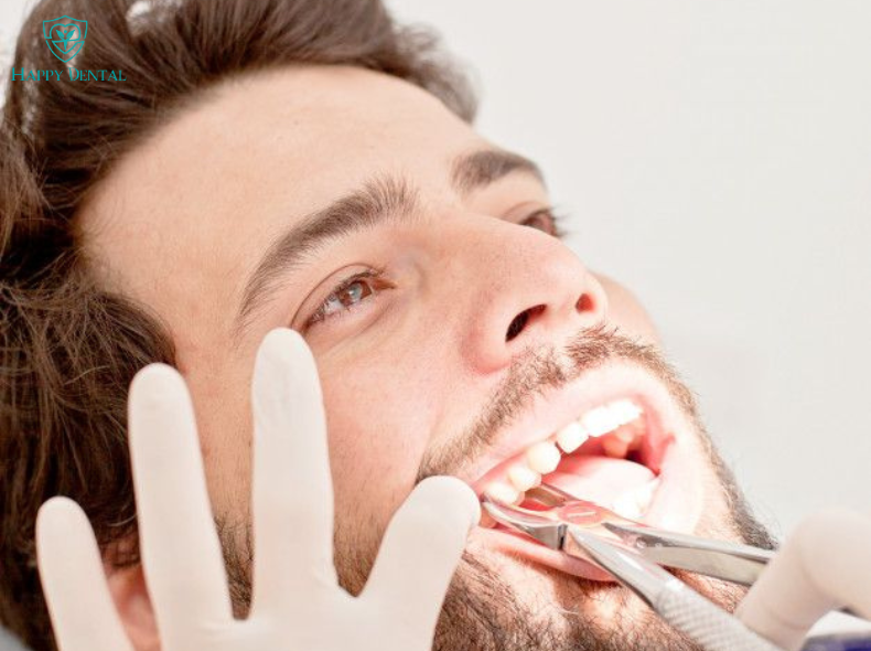 Chăm sóc răng sau nhổ răng
