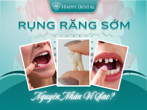 rụng răng sớm